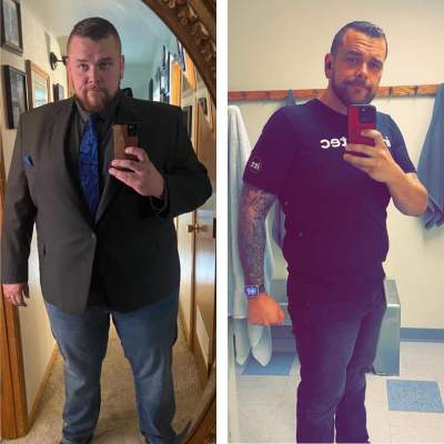 Wyatt-D-Before-and-After-Gastric-Bypass.png Wyatt-D-Before-and-After-Gastric-Bypass.png