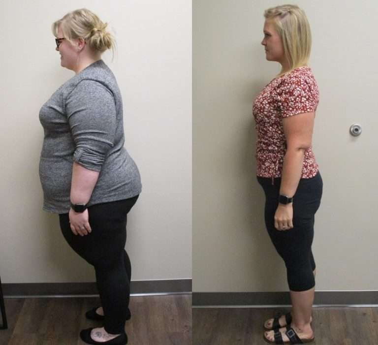 gastric-sleeve.jpg gastric-sleeve.jpg